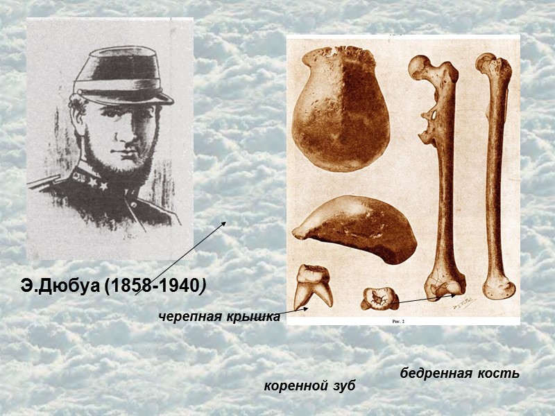 Э.Дюбуа (1858-1940) бедренная кость черепная крышка коренной зуб